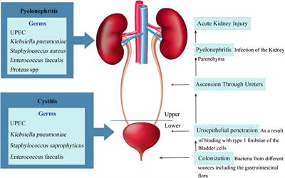 The Burden of the Serious and Difficult-to-Treat Infections and a New Antibiotic Available: Cefiderocol